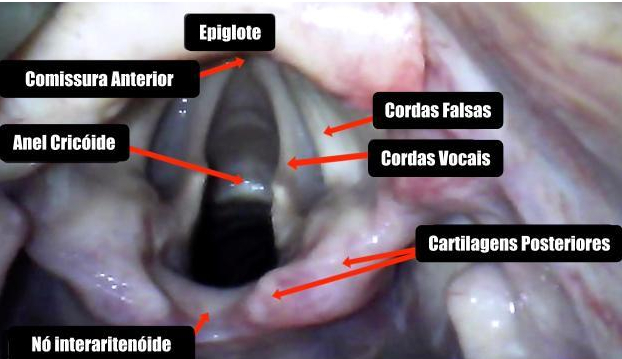 Anatomia das Vias&nbsp;Aéreas