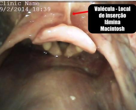 Anatomia das Vias Aéreas (4)