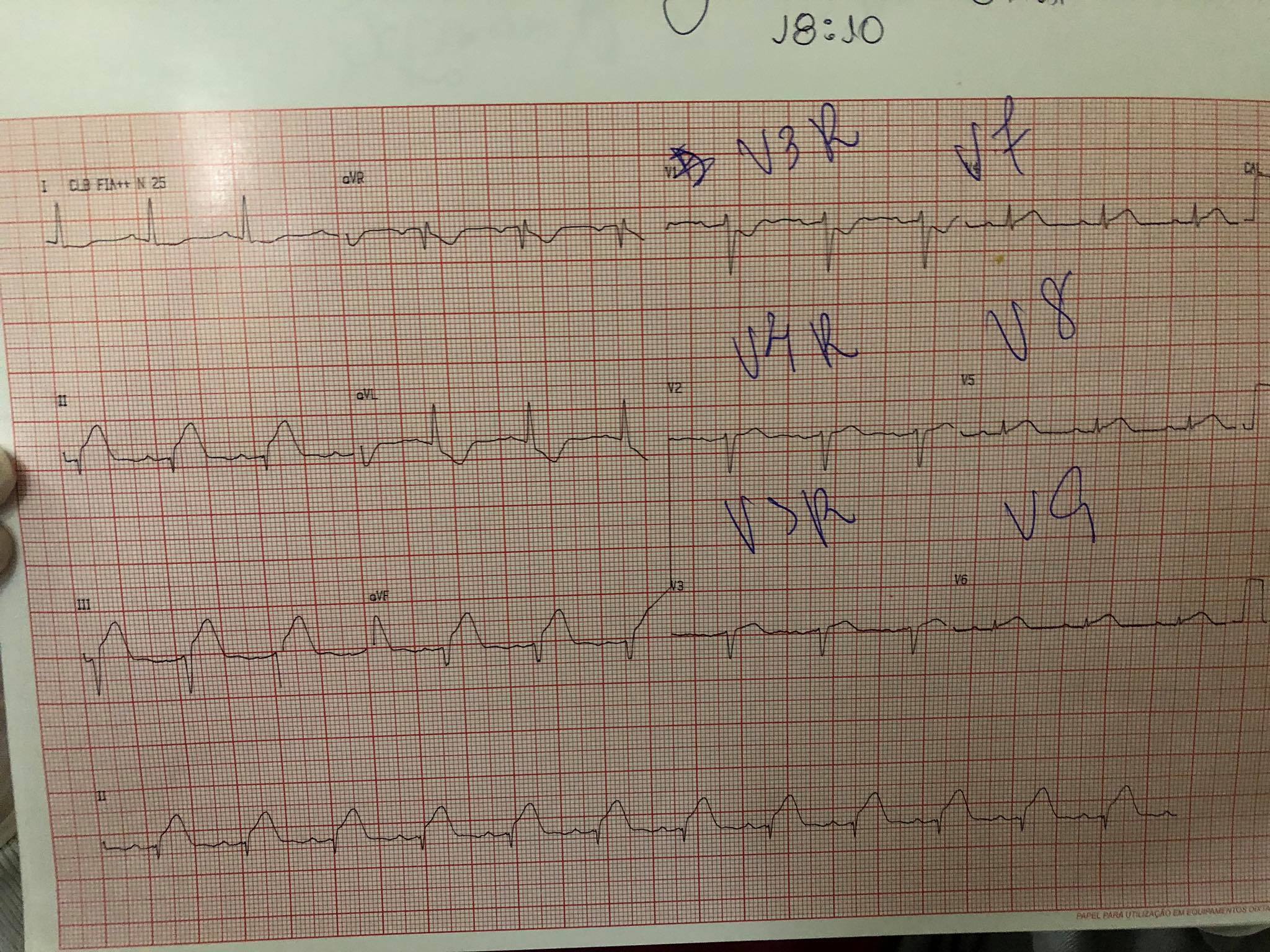 45782276_1092117970952955_3212859116225560576_o